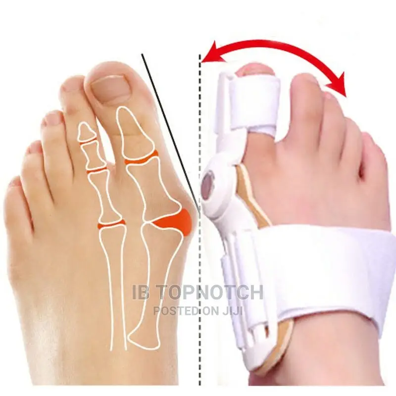 2pcs/Pair Bunion Orthopaedic Brace for Big Toe Correction