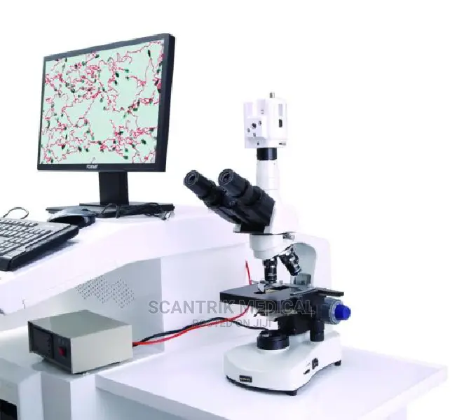 Analyzer Semen Analyzer Sperm Analysis Machine