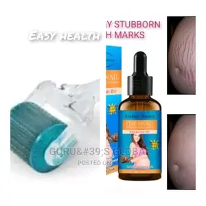 Derma Roller for Stretch Marks and Clothings