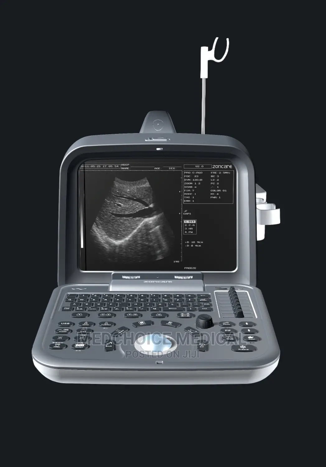 2d Table Top Ultrasound Machine