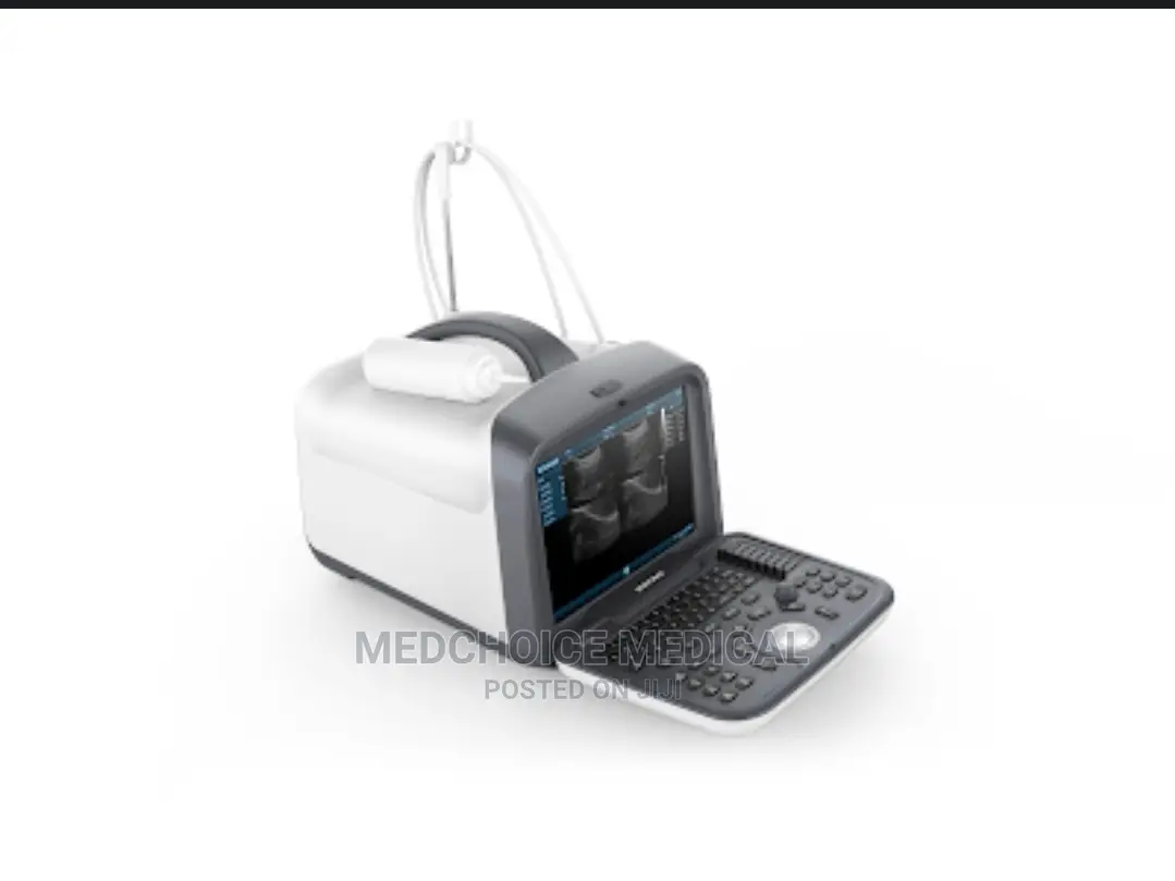 2d Table Top Ultrasound Machine