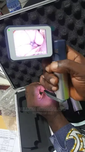 Video Laryngoscope
