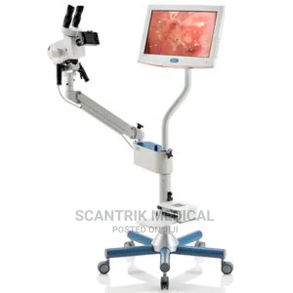 Colposcopy Binocular