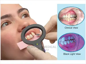 Medical Dental Light Tri-Spectra Shade Guide Tooth Color