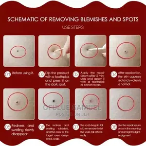 10 in Selfie Ringlight