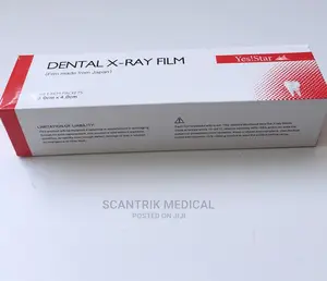 High Quality Dental X Ray Film Reader for Clinic