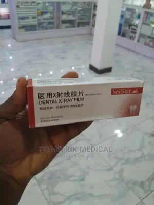 X - Ray Film Reader Scanner Machine for Clinical Hospital