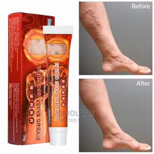 Varicose Vein Cream -20g