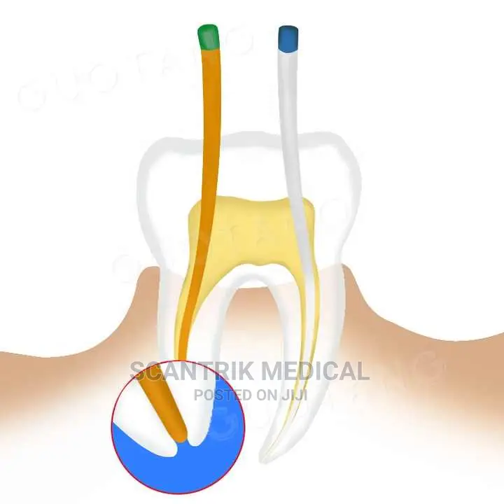 Dental Absorbent Paper Points