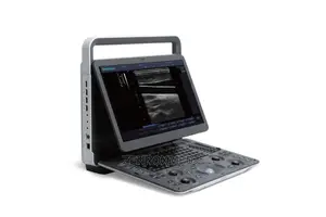 Sonoscape E1 Exp Ultrasound Nigeria