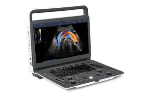 Sonoscape E2 Color Ultrasound Nigeria