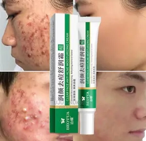 Pimple,Acne, Scar and Blemish Removal Cream